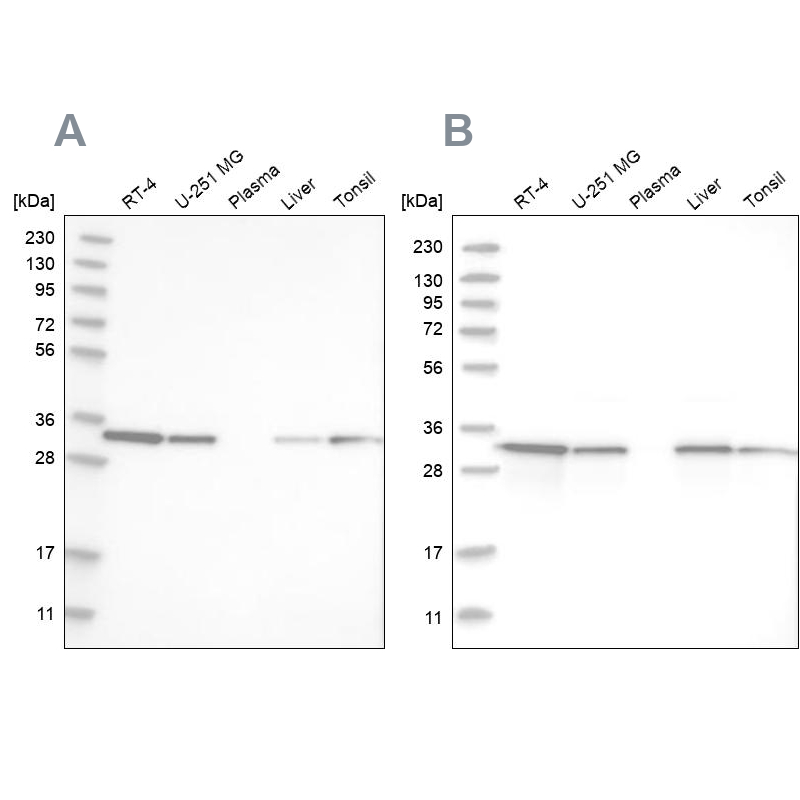 Western blot analysis using Anti-GLOD4 antibody HPA021623 (A) shows similar pattern to independent antibody HPA023246 (B).