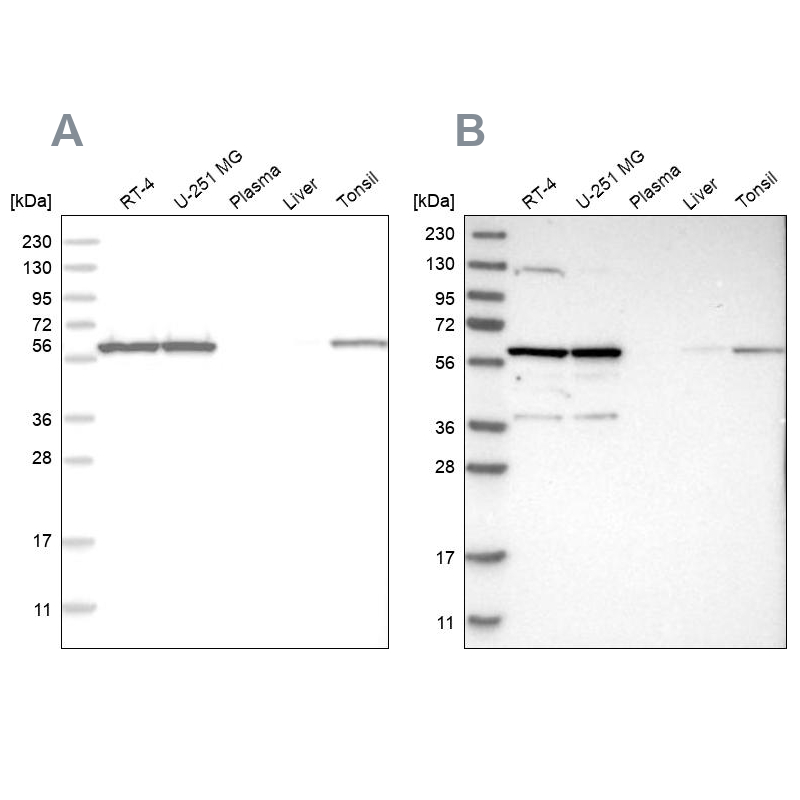 Western blot analysis using Anti-PRPF4 antibody HPA021794 (A) shows similar pattern to independent antibody HPA022248 (B). Western blot analysis using Anti-PRPF4 antibody HPA021794 (A) shows similar pattern to independent antibody HPA022248 (B).