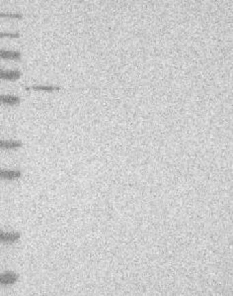 Lane 1: Marker [kDa] 230, 130, 95, 72, 56, 36, 28, 17, 11 | Lane 2: RT4 | Lane 3: U-251 MG | Lane 4: Human Plasma | Lane 5: Liver | Lane 6: Tonsil