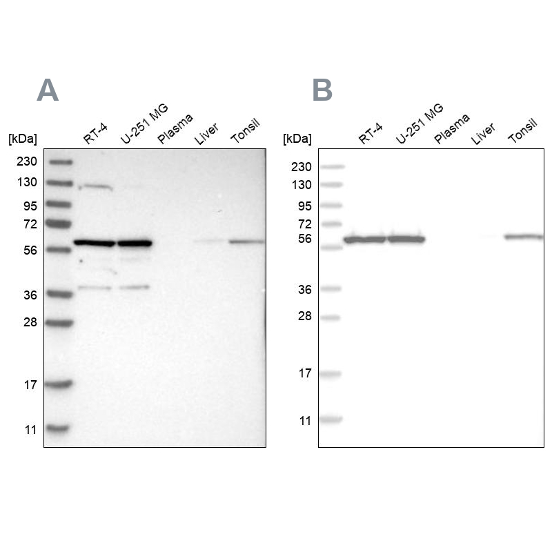 Western blot analysis using Anti-PRPF4 antibody HPA022248 (A) shows similar pattern to independent antibody HPA021794 (B). Western blot analysis using Anti-PRPF4 antibody HPA022248 (A) shows similar pattern to independent antibody HPA021794 (B).