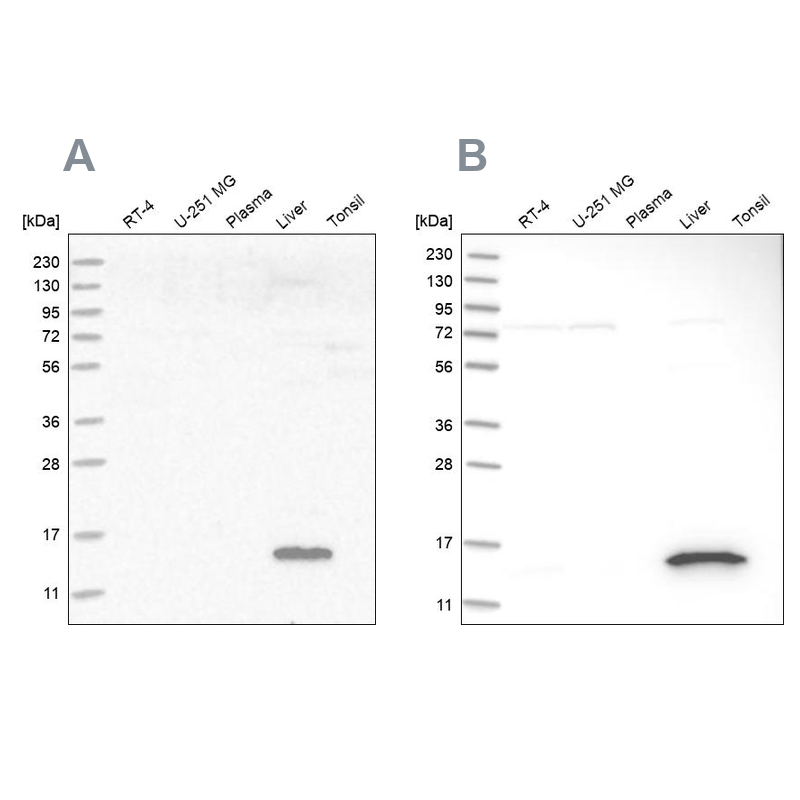 Western blot analysis using Anti-RIDA antibody HPA022856 (A) shows similar pattern to independent antibody HPA023489 (B).