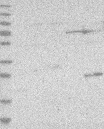 Lane 1: Marker [kDa] 230, 130, 95, 72, 56, 36, 28, 17, 11 | Lane 2: RT4 | Lane 3: U-251 MG | Lane 4: Human Plasma | Lane 5: Liver | Lane 6: Tonsil