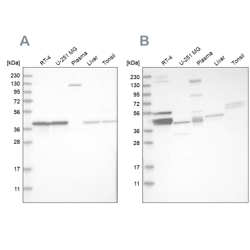 Western blot analysis using Anti-MRPL38 antibody HPA023054 (A) shows similar pattern to independent antibody HPA023135 (B).