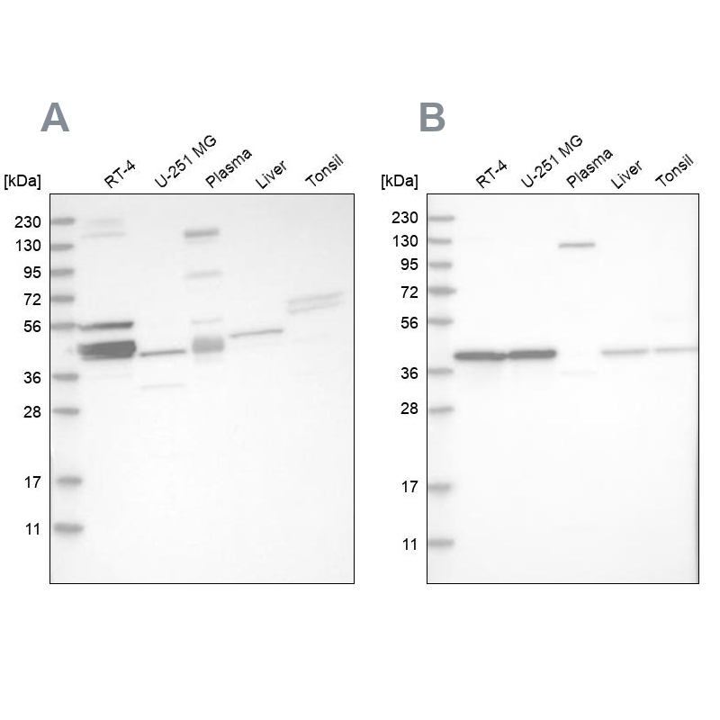 Western blot analysis using Anti-MRPL38 antibody HPA023135 (A) shows similar pattern to independent antibody HPA023054 (B).
