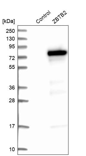 Western blot analysis in control (vector only transfected HEK293T lysate) and ZBTB2 over-expression lysate (Co-expressed with a C-terminal myc-DDK tag (~3.1 kDa) in mammalian HEK293T cells, LY412230). Western blot analysis in control (vector only transfected HEK293T lysate) and ZBTB2 over-expression lysate (Co-expressed with a C-terminal myc-DDK tag (~3.1 kDa) in mammalian HEK293T cells, LY412230).
