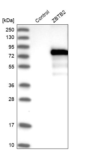 Western blot analysis in control (vector only transfected HEK293T lysate) and ZBTB2 over-expression lysate (Co-expressed with a C-terminal myc-DDK tag (~3.1 kDa) in mammalian HEK293T cells, LY412230). Western blot analysis in control (vector only transfected HEK293T lysate) and ZBTB2 over-expression lysate (Co-expressed with a C-terminal myc-DDK tag (~3.1 kDa) in mammalian HEK293T cells, LY412230).