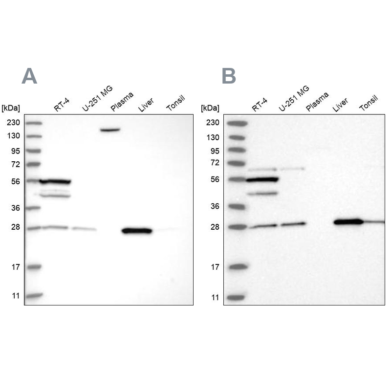 Western blot analysis using Anti-PNPO antibody HPA023204 (A) shows similar pattern to independent antibody HPA027776 (B).