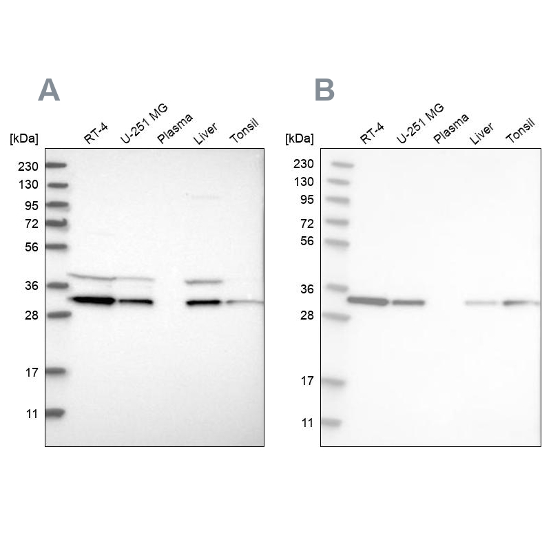 Western blot analysis using Anti-GLOD4 antibody HPA023248 (A) shows similar pattern to independent antibody HPA021623 (B).