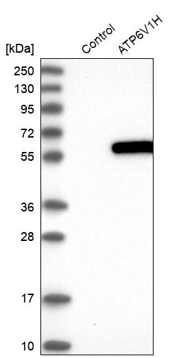 Western blot analysis in control (vector only transfected HEK293T lysate) and ATP6V1H over-expression lysate (Co-expressed with a C-terminal myc-DDK tag (~3.1 kDa) in mammalian HEK293T cells, LY414295).