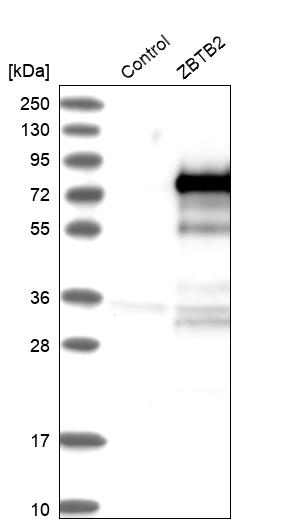 Western blot analysis in control (vector only transfected HEK293T lysate) and ZBTB2 over-expression lysate (Co-expressed with a C-terminal myc-DDK tag (~3.1 kDa) in mammalian HEK293T cells, LY412230). Western blot analysis in control (vector only transfected HEK293T lysate) and ZBTB2 over-expression lysate (Co-expressed with a C-terminal myc-DDK tag (~3.1 kDa) in mammalian HEK293T cells, LY412230).