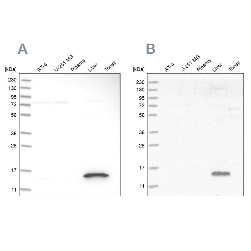 Western blot analysis using Anti-RIDA antibody HPA023489 (A) shows similar pattern to independent antibody HPA022856 (B). Western blot analysis using Anti-RIDA antibody HPA023489 (A) shows similar pattern to independent antibody HPA022856 (B).