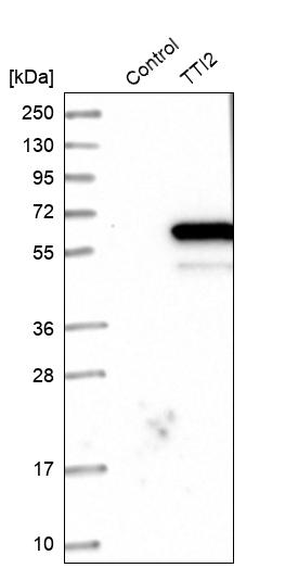 Western blot analysis in control (vector only transfected HEK293T lysate) and TTI2 over-expression lysate (Co-expressed with a C-terminal myc-DDK tag (~3.1 kDa) in mammalian HEK293T cells, LY410894). Western blot analysis in control (vector only transfected HEK293T lysate) and TTI2 over-expression lysate (Co-expressed with a C-terminal myc-DDK tag (~3.1 kDa) in mammalian HEK293T cells, LY410894).