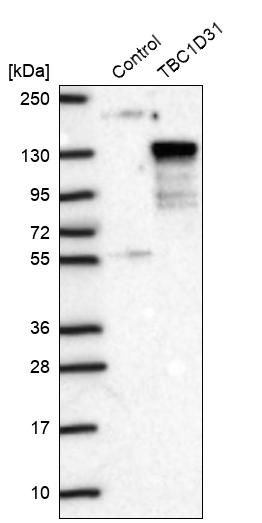 Western blot analysis in control (vector only transfected HEK293T lysate) and TBC1D31 over-expression lysate (Co-expressed with a C-terminal myc-DDK tag (~3.1 kDa) in mammalian HEK293T cells, LY407919). Western blot analysis in control (vector only transfected HEK293T lysate) and TBC1D31 over-expression lysate (Co-expressed with a C-terminal myc-DDK tag (~3.1 kDa) in mammalian HEK293T cells, LY407919).
