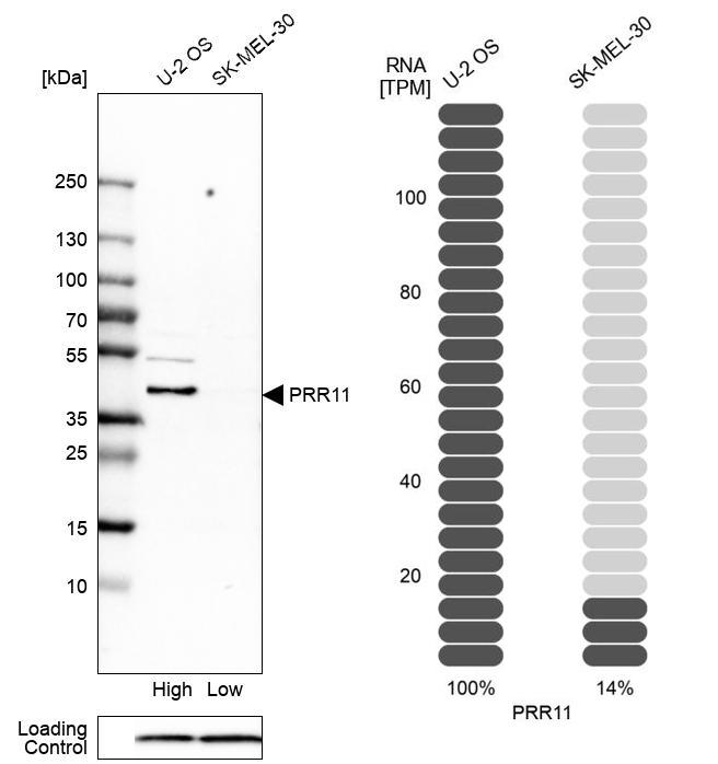 Western blot analysis in human cell lines U2OS and SK-MEL-30 using Anti-PRR11 antibody. Corresponding PRR11 RNA-seq data are presented for the same cell lines. Loading control: Anti-COX4I1. Western blot analysis in human cell lines U2OS and SK-MEL-30 using Anti-PRR11 antibody. Corresponding PRR11 RNA-seq data are presented for the same cell lines. Loading control: Anti-COX4I1.