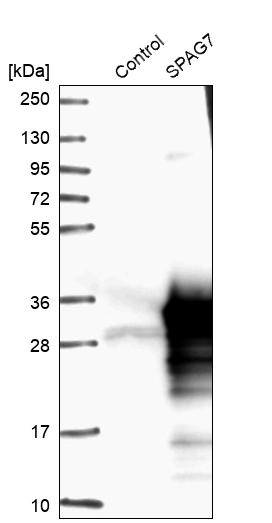 Western blot analysis in control (vector only transfected HEK293T lysate) and SPAG7 over-expression lysate (Co-expressed with a C-terminal myc-DDK tag (~3.1 kDa) in mammalian HEK293T cells, LY417676). Western blot analysis in control (vector only transfected HEK293T lysate) and SPAG7 over-expression lysate (Co-expressed with a C-terminal myc-DDK tag (~3.1 kDa) in mammalian HEK293T cells, LY417676).