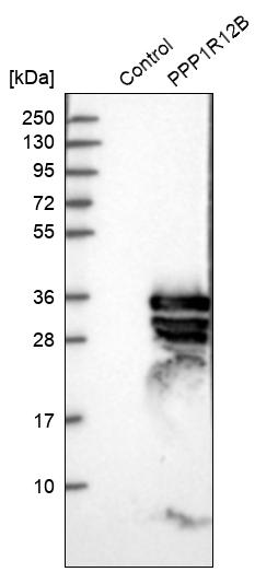 Western blot analysis in control (vector only transfected HEK293T lysate) and PPP1R12B over-expression lysate (Co-expressed with a C-terminal myc-DDK tag (~3.1 kDa) in mammalian HEK293T cells, LY410386). Western blot analysis in control (vector only transfected HEK293T lysate) and PPP1R12B over-expression lysate (Co-expressed with a C-terminal myc-DDK tag (~3.1 kDa) in mammalian HEK293T cells, LY410386).
