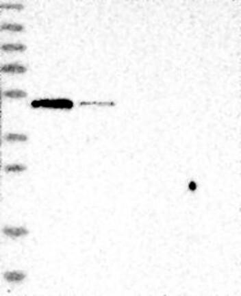 Lane 1: Marker [kDa] 230, 130, 95, 72, 56, 36, 28, 17, 11 | Lane 2: RT4 | Lane 3: U-251 MG | Lane 4: Human Plasma | Lane 5: Liver | Lane 6: Tonsil