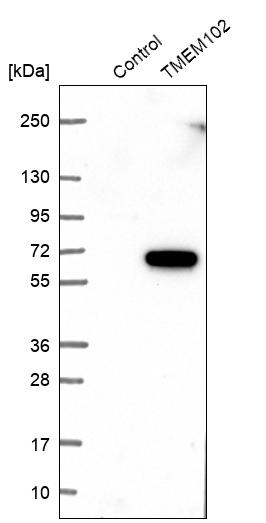 Western blot analysis in control (vector only transfected HEK293T lysate) and TMEM102 over-expression lysate (Co-expressed with a C-terminal myc-DDK tag (~3.1 kDa) in mammalian HEK293T cells, LY405901). Western blot analysis in control (vector only transfected HEK293T lysate) and TMEM102 over-expression lysate (Co-expressed with a C-terminal myc-DDK tag (~3.1 kDa) in mammalian HEK293T cells, LY405901).