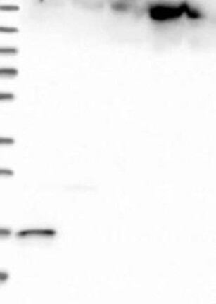 Lane 1: Marker [kDa] 230, 130, 95, 72, 56, 36, 28, 17, 11 | Lane 2: RT4 | Lane 3: U-251 MG | Lane 4: Human Plasma | Lane 5: Liver | Lane 6: Tonsil