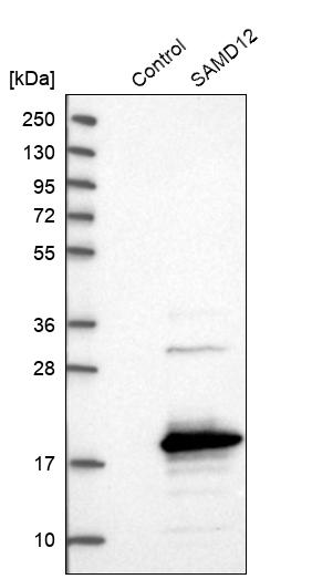 Western blot analysis in control (vector only transfected HEK293T lysate) and SAMD12 over-expression lysate (Co-expressed with a C-terminal myc-DDK tag (~3.1 kDa) in mammalian HEK293T cells, LY404050). Western blot analysis in control (vector only transfected HEK293T lysate) and SAMD12 over-expression lysate (Co-expressed with a C-terminal myc-DDK tag (~3.1 kDa) in mammalian HEK293T cells, LY404050).