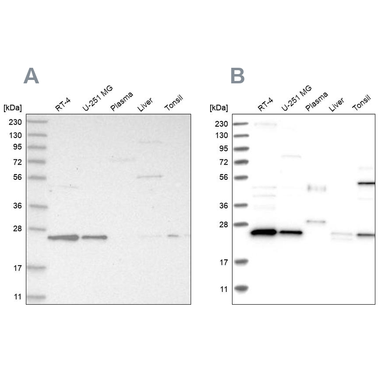 Western blot analysis using Anti-VPS28 antibody HPA024745 (A) shows similar pattern to independent antibody HPA024688 (B).