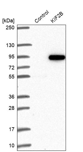 Western blot analysis in control (vector only transfected HEK293T lysate) and KIF2B over-expression lysate (Co-expressed with a C-terminal myc-DDK tag (~3.1 kDa) in mammalian HEK293T cells, LY410047). Western blot analysis in control (vector only transfected HEK293T lysate) and KIF2B over-expression lysate (Co-expressed with a C-terminal myc-DDK tag (~3.1 kDa) in mammalian HEK293T cells, LY410047).