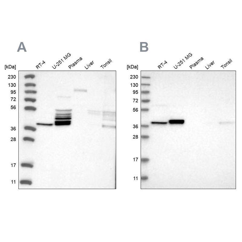 Western blot analysis using Anti-ACOT7 antibody HPA025762 (A) shows similar pattern to independent antibody HPA025735 (B).
