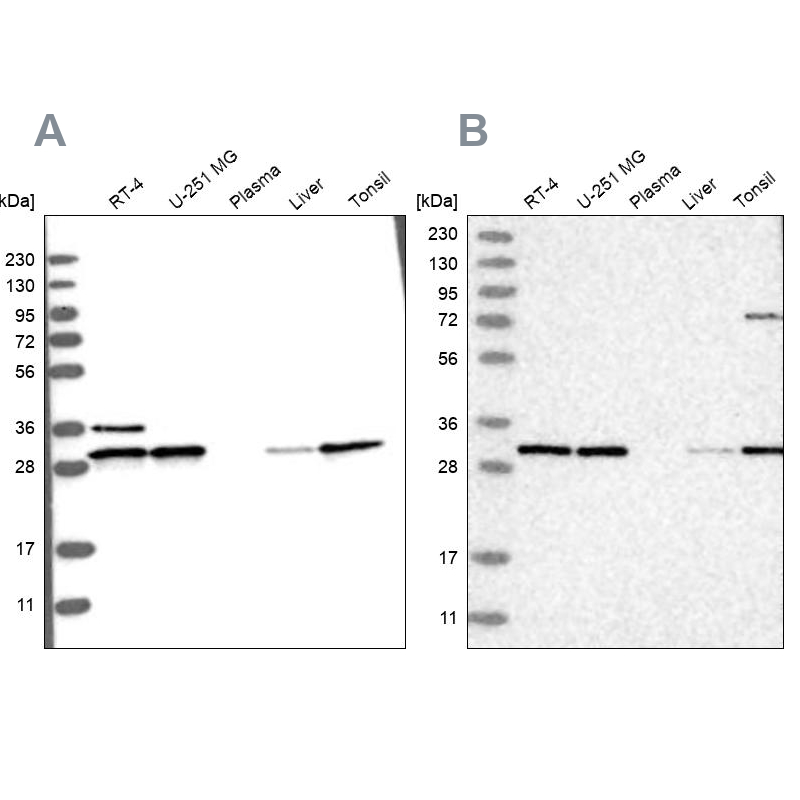 Western blot analysis using Anti-RPA2 antibody HPA026306 (A) shows similar pattern to independent antibody HPA026309 (B).