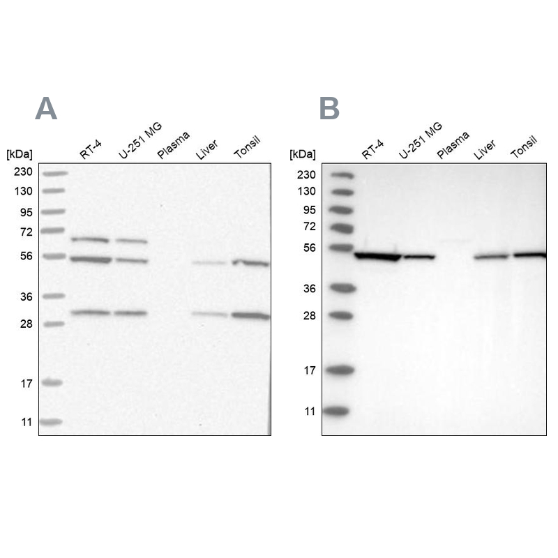 Western blot analysis using Anti-STK24 antibody HPA026435 (A) shows similar pattern to independent antibody HPA026502 (B).