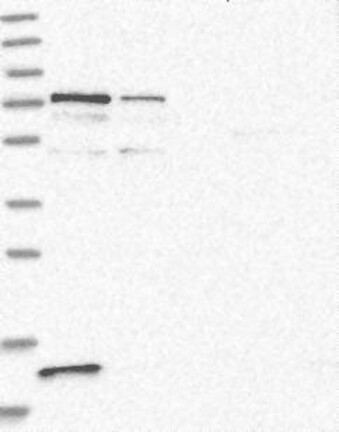 Lane 1: Marker [kDa] 230, 130, 95, 72, 56, 36, 28, 17, 11 | Lane 2: RT4 | Lane 3: U-251 MG | Lane 4: Human Plasma | Lane 5: Liver | Lane 6: Tonsil
