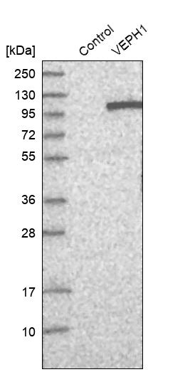 Western blot analysis in control (vector only transfected HEK293T lysate) and VEPH1 over-expression lysate (Co-expressed with a C-terminal myc-DDK tag (~3.1 kDa) in mammalian HEK293T cells, LY403012).