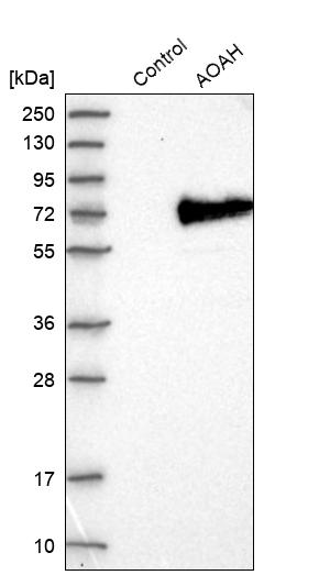 Western blot analysis in control (vector only transfected HEK293T lysate) and AOAH over-expression lysate (Co-expressed with a C-terminal myc-DDK tag (~3.1 kDa) in mammalian HEK293T cells, LY400615). Western blot analysis in control (vector only transfected HEK293T lysate) and AOAH over-expression lysate (Co-expressed with a C-terminal myc-DDK tag (~3.1 kDa) in mammalian HEK293T cells, LY400615).