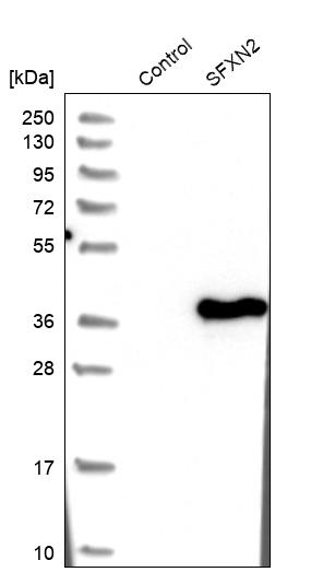 Western blot analysis in control (vector only transfected HEK293T lysate) and SFXN2 over-expression lysate (Co-expressed with a C-terminal myc-DDK tag (~3.1 kDa) in mammalian HEK293T cells, LY403612). Western blot analysis in control (vector only transfected HEK293T lysate) and SFXN2 over-expression lysate (Co-expressed with a C-terminal myc-DDK tag (~3.1 kDa) in mammalian HEK293T cells, LY403612).