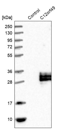 Western blot analysis in control (vector only transfected HEK293T lysate) and C12orf49 over-expression lysate (Co-expressed with a C-terminal myc-DDK tag (~3.1 kDa) in mammalian HEK293T cells, LY403023).