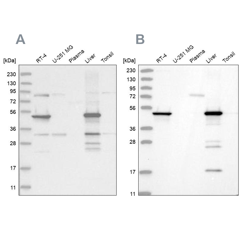 Western blot analysis using Anti-HMGCS2 antibody HPA027423 (A) shows similar pattern to independent antibody HPA027442 (B). Western blot analysis using Anti-HMGCS2 antibody HPA027423 (A) shows similar pattern to independent antibody HPA027442 (B).