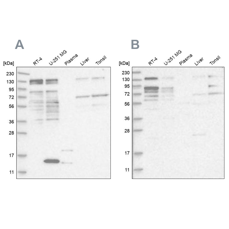 Western blot analysis using Anti-PUM1 antibody HPA027424 (A) shows similar pattern to independent antibody HPA027449 (B).