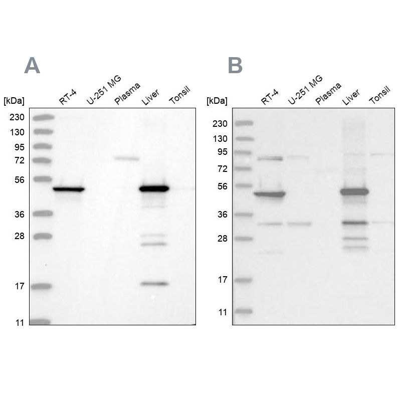 Western blot analysis using Anti-HMGCS2 antibody HPA027442 (A) shows similar pattern to independent antibody HPA027423 (B).