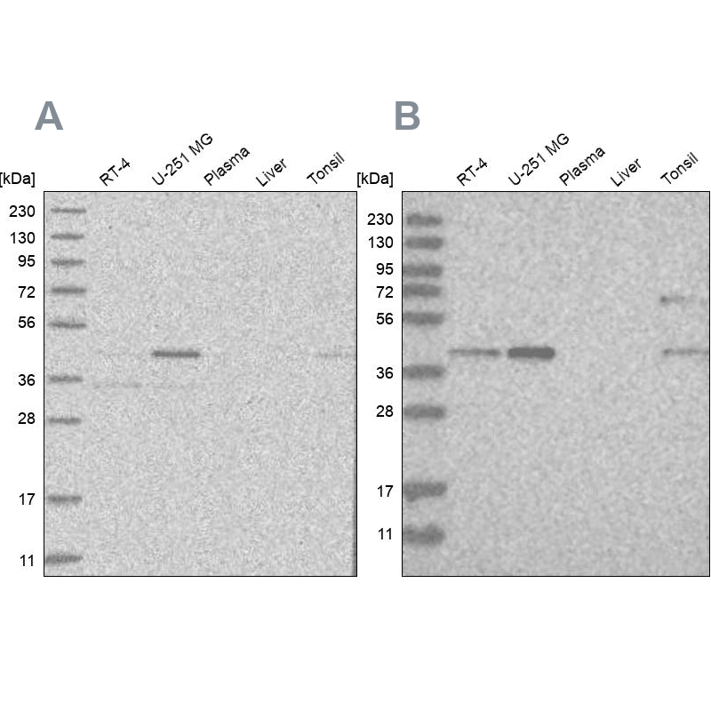 Western blot analysis using Anti-RTCA antibody HPA027990 (A) shows similar pattern to independent antibody HPA027982 (B). Western blot analysis using Anti-RTCA antibody HPA027990 (A) shows similar pattern to independent antibody HPA027982 (B).