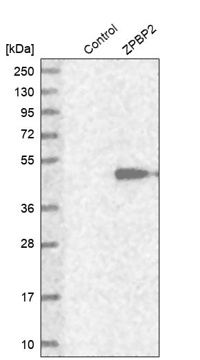 Western blot analysis in control (vector only transfected HEK293T lysate) and ZPBP2 over-expression lysate (Co-expressed with a C-terminal myc-DDK tag (~3.1 kDa) in mammalian HEK293T cells, LY403691).