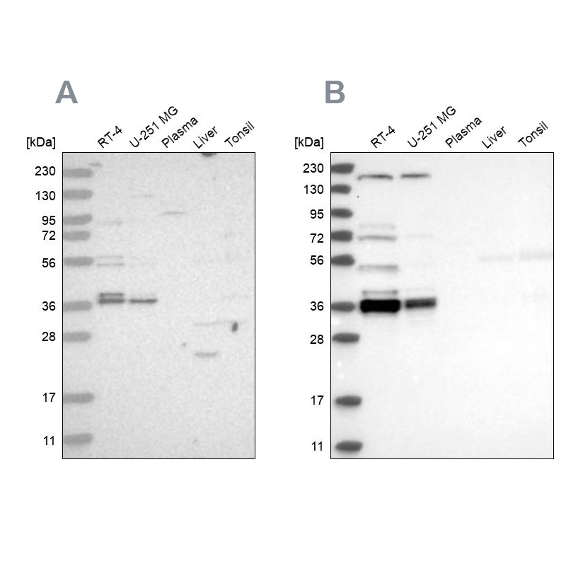 Western blot analysis using Anti-C1orf131 antibody HPA028452 (A) shows similar pattern to independent antibody HPA029920 (B). Western blot analysis using Anti-C1orf131 antibody HPA028452 (A) shows similar pattern to independent antibody HPA029920 (B).