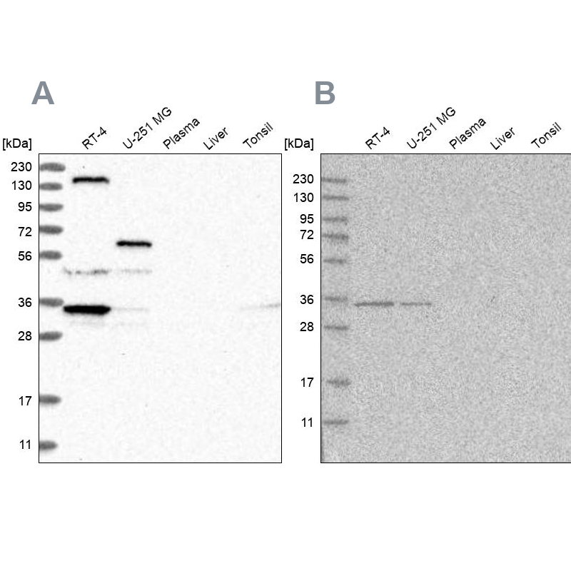 Western blot analysis using Anti-PPP1R42 antibody HPA028628 (A) shows similar pattern to independent antibody HPA027983 (B).