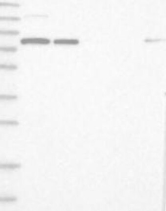 Lane 1: Marker [kDa] 230, 130, 95, 72, 56, 36, 28, 17, 11 | Lane 2: RT4 | Lane 3: U-251 MG | Lane 4: Human Plasma | Lane 5: Liver | Lane 6: Tonsil