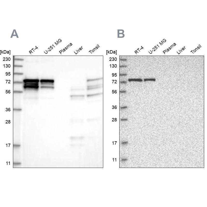 Western blot analysis using Anti-PPP2R5D antibody HPA029045 (A) shows similar pattern to independent antibody HPA029046 (B).