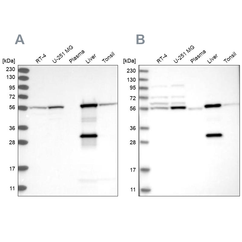 Western blot analysis using Anti-ALDH6A1 antibody HPA029074 (A) shows similar pattern to independent antibody HPA029073 (B).