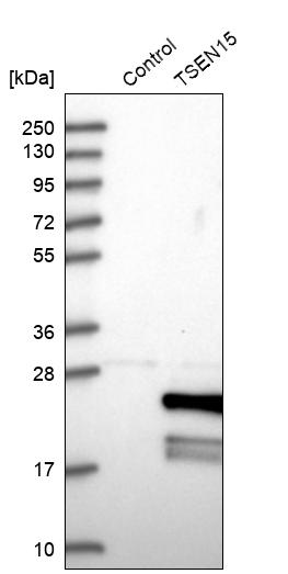 Western blot analysis in control (vector only transfected HEK293T lysate) and TSEN15 over-expression lysate (Co-expressed with a C-terminal myc-DDK tag (~3.1 kDa) in mammalian HEK293T cells, LY409366). Western blot analysis in control (vector only transfected HEK293T lysate) and TSEN15 over-expression lysate (Co-expressed with a C-terminal myc-DDK tag (~3.1 kDa) in mammalian HEK293T cells, LY409366).