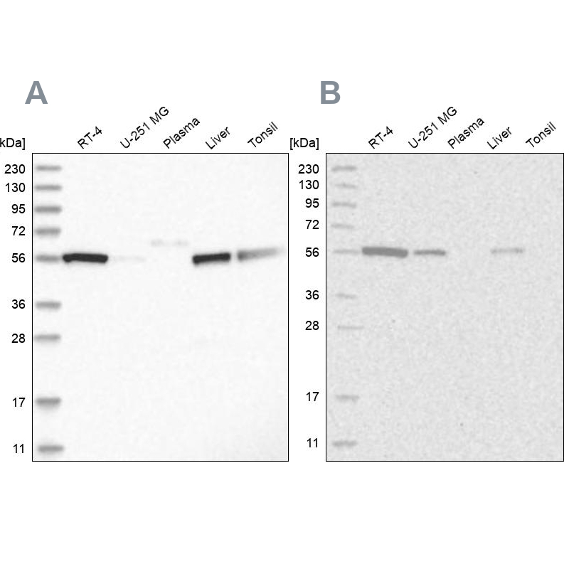 Western blot analysis using Anti-ALDH5A1 antibody HPA029715 (A) shows similar pattern to independent antibody HPA029716 (B).
