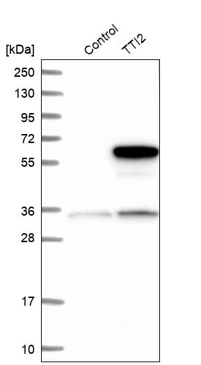 Western blot analysis in control (vector only transfected HEK293T lysate) and TTI2 over-expression lysate (Co-expressed with a C-terminal myc-DDK tag (~3.1 kDa) in mammalian HEK293T cells, LY410894). Western blot analysis in control (vector only transfected HEK293T lysate) and TTI2 over-expression lysate (Co-expressed with a C-terminal myc-DDK tag (~3.1 kDa) in mammalian HEK293T cells, LY410894).