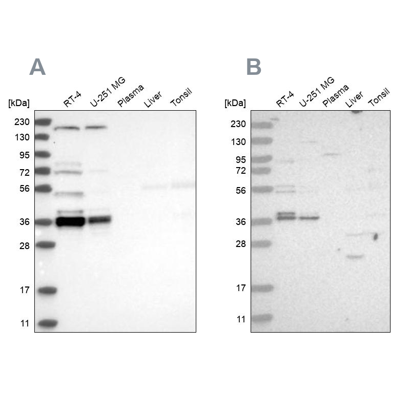 Western blot analysis using Anti-C1orf131 antibody HPA029920 (A) shows similar pattern to independent antibody HPA028452 (B). Western blot analysis using Anti-C1orf131 antibody HPA029920 (A) shows similar pattern to independent antibody HPA028452 (B).
