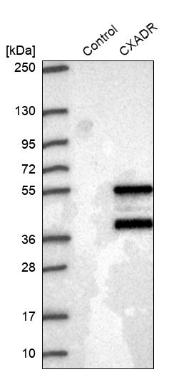 Western blot analysis in control (vector only transfected HEK293T lysate) and CXADR over-expression lysate (Co-expressed with a C-terminal myc-DDK tag (~3.1 kDa) in mammalian HEK293T cells, LY419998). Western blot analysis in control (vector only transfected HEK293T lysate) and CXADR over-expression lysate (Co-expressed with a C-terminal myc-DDK tag (~3.1 kDa) in mammalian HEK293T cells, LY419998).