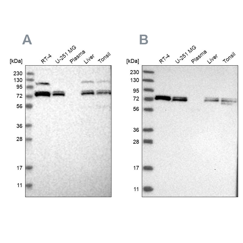 Western blot analysis using Anti-XPNPEP1 antibody HPA030419 (A) shows similar pattern to independent antibody HPA030420 (B). Western blot analysis using Anti-XPNPEP1 antibody HPA030419 (A) shows similar pattern to independent antibody HPA030420 (B).
